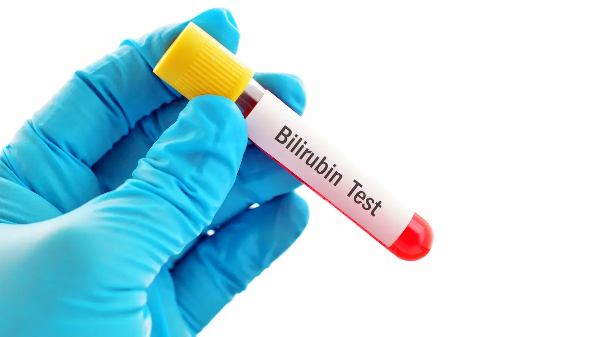Bilirrubinas Total e Frações
