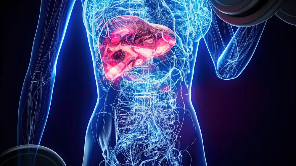 como a obesidade pode levar à MASH e à esteatose hepática